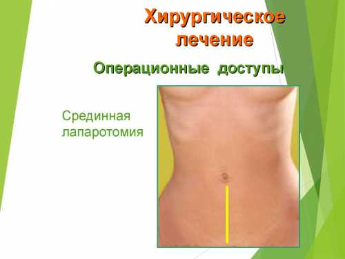 В связи с тем, что клинические симптомы хронического течения аппендицита расплывчаты и смазаны, диагностика болезни вызывает определенные трудности